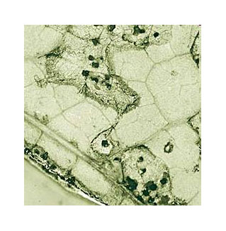 rostpilz Der Pilz Microsphaeropsis greift einen schädlichen Rostpilz an. Lichtmikroskopische Aufnahme eines Johnnisbeer-Blattes.